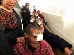患白内障多年的他,在成都爱尔眼科重
