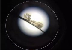 每5人中就有1人患的干眼症,如何有效防