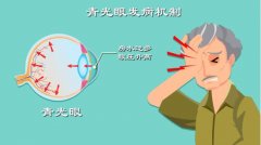 世界青光眼日|宁波博视眼科俞存:青光眼可致盲,早期防治极重要